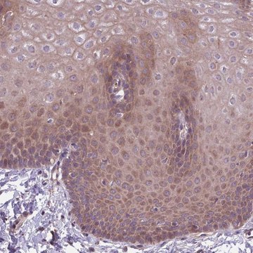 Anti-ITPKC antibody produced in rabbit