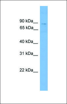 Anti-QARS, (N-terminal) antibody produced in