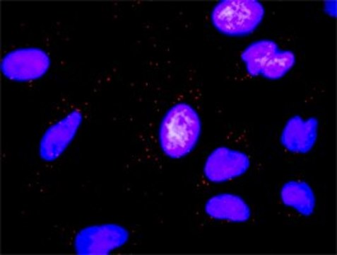 Anti-MMP7 antibody produced in rabbit