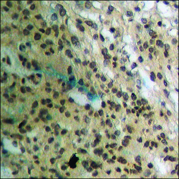 Anti-phospho-IKK-? (pTyr¹??) antibody produced in
