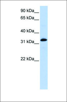 Anti-TNNT2 antibody produced in rabbit
