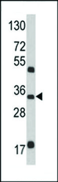 ANTI-M6PR(N-TERMINAL) antibody produced in rabbit