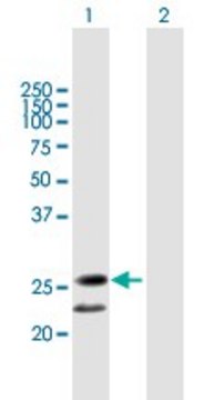 Anti-C20ORF71 antibody produced in mouse
