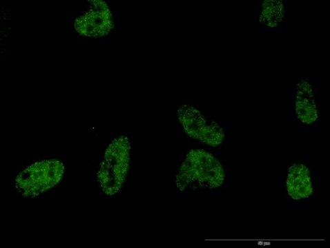 Monoclonal Anti-PLCB2 antibody produced in