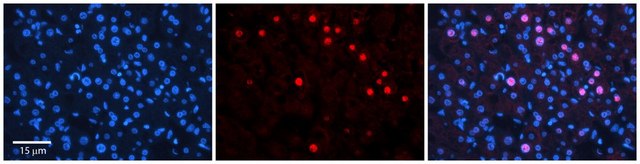 Anti-RAD54B (ab3) antibody produced in