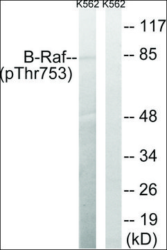 Anti-phospho-B-Raf (pThr??³) antibody produced in