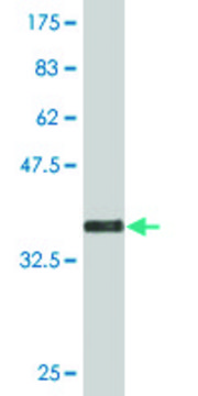 Monoclonal Anti-RNF148 antibody produced in