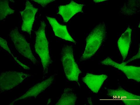 Monoclonal Anti-DPYSL5 antibody produced in