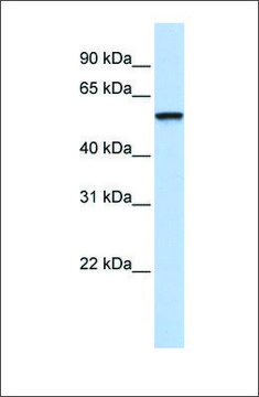 Anti-TRIM4 antibody produced in rabbit