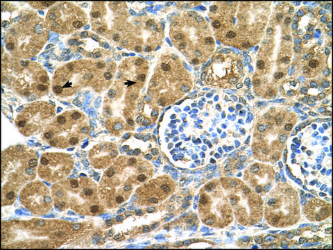 Anti-PTGDS antibody produced in rabbit