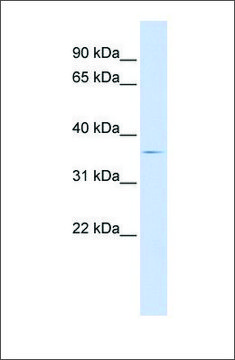 Anti-TRIB2 antibody produced in rabbit
