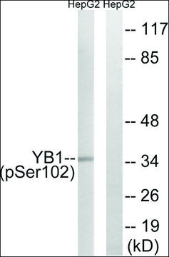 Anti-phospho-YB1 (pSer¹?²) antibody produced in
