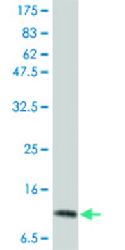 Monoclonal Anti-IL2, (C-terminal) antibody produced