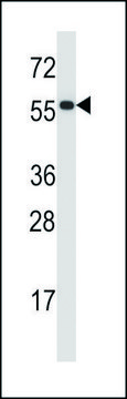 ANTI-PDIA2 (CENTER) antibody produced in