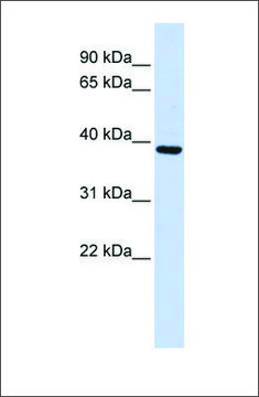 Anti-FBXO24 (ab1) antibody produced in