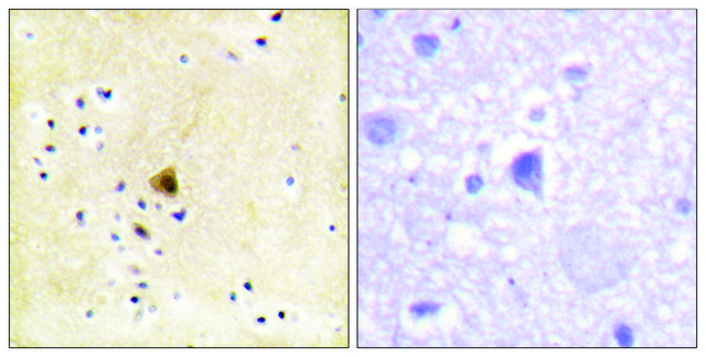 Anti-RYR2 antibody produced in rabbit