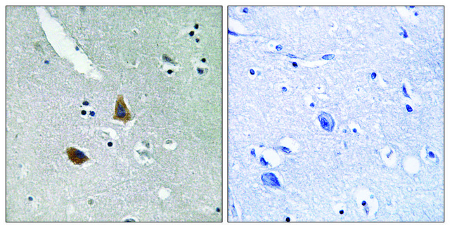 Anti-MRPL21 antibody produced in rabbit