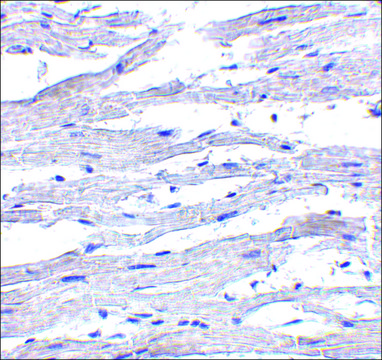 Anti-RIG-1 antibody produced in rabbit