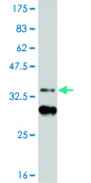 ANTI-HIC1 antibody produced in mouse