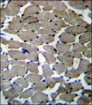 ANTI-MGAT4C (C-TERM) antibody produced in