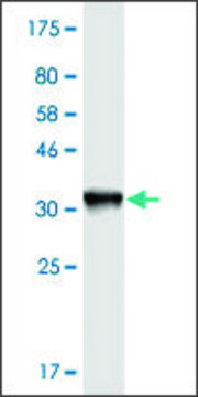 Monoclonal Anti-KNTC1, (C-terminal) antibody produced
