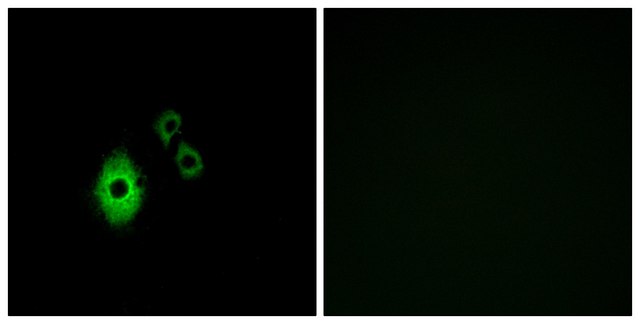 Anti-KCNJ5 antibody produced in rabbit