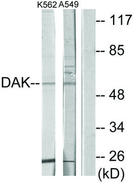 Anti-DAK antibody produced in rabbit