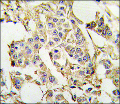 Anti-PARS2 (center) antibody produced in