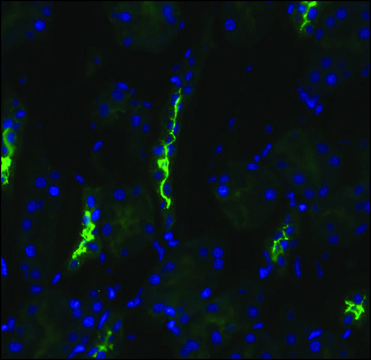 Anti-SLC12A3 antibody produced in rabbit