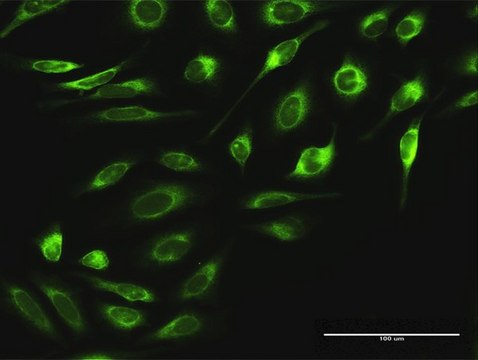 Anti-RPN2 antibody produced in rabbit
