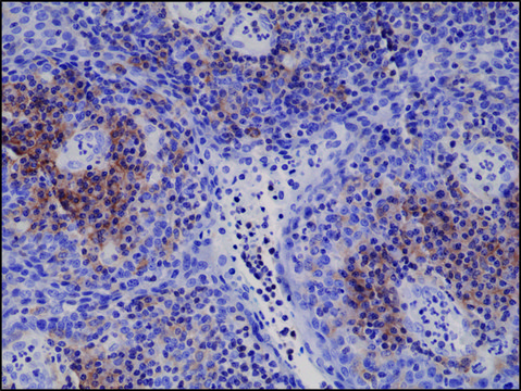 Anti-Integrin alpha 4 antibody, Rabbit