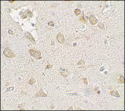 Anti-FMR1 antibody produced in rabbit