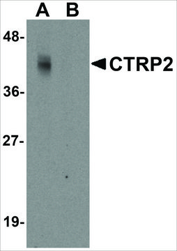 Anti-CTRP2 (ab2) antibody produced in