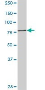 Anti-PFKM antibody produced in rabbit