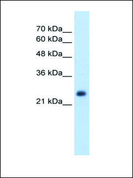 Anti-NNMT antibody produced in rabbit