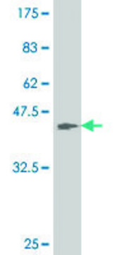 ANTI-ATOH1 antibody produced in mouse