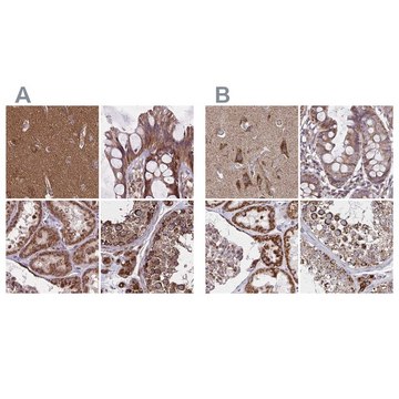 Anti-NFS1 antibody produced in rabbit