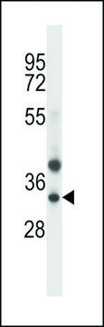ANTI-TRIM34(N-TERMINAL) antibody produced in rabbit