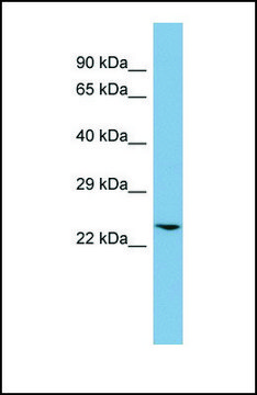Anti-GLO1, (N-terminal) antibody produced in