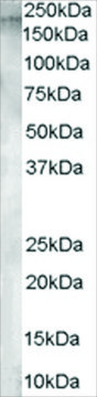 Anti-Aminopeptidase A antibody produced in