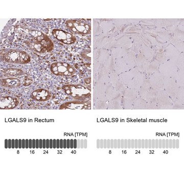 Anti-LGALS9 antibody produced in rabbit