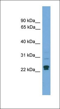 Anti-TP53INP2 antibody produced in rabbit