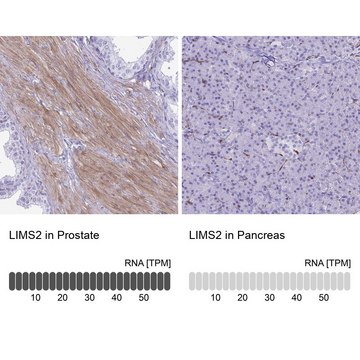 Anti-LIMS2 antibody produced in rabbit