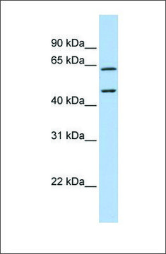 Anti-CECR1 antibody produced in rabbit