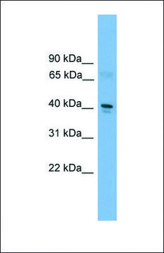 Anti-TFDP2, (C-terminal) antibody produced in