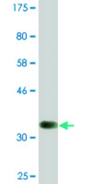Monoclonal Anti-TAF5L, (N-terminal) antibody produced