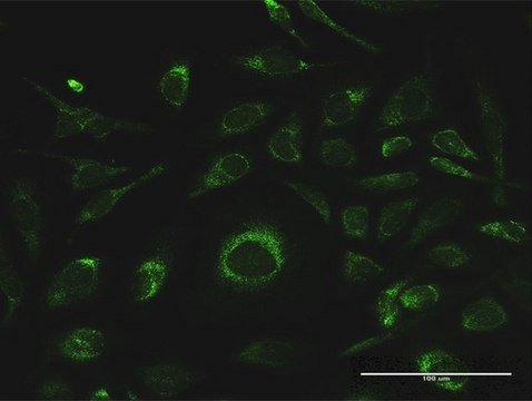 Anti-GSTK1 antibody produced in rabbit
