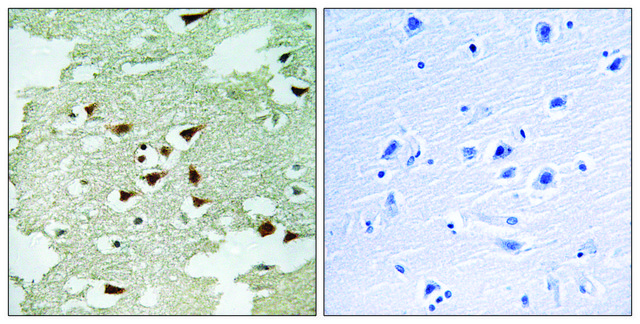 Anti-AKT antibody produced in rabbit