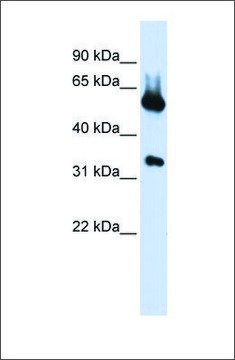 Anti-ALAS2 (ab1) antibody produced in