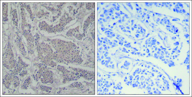 Anti-SMAD3 (Ab-425) antibody produced in
